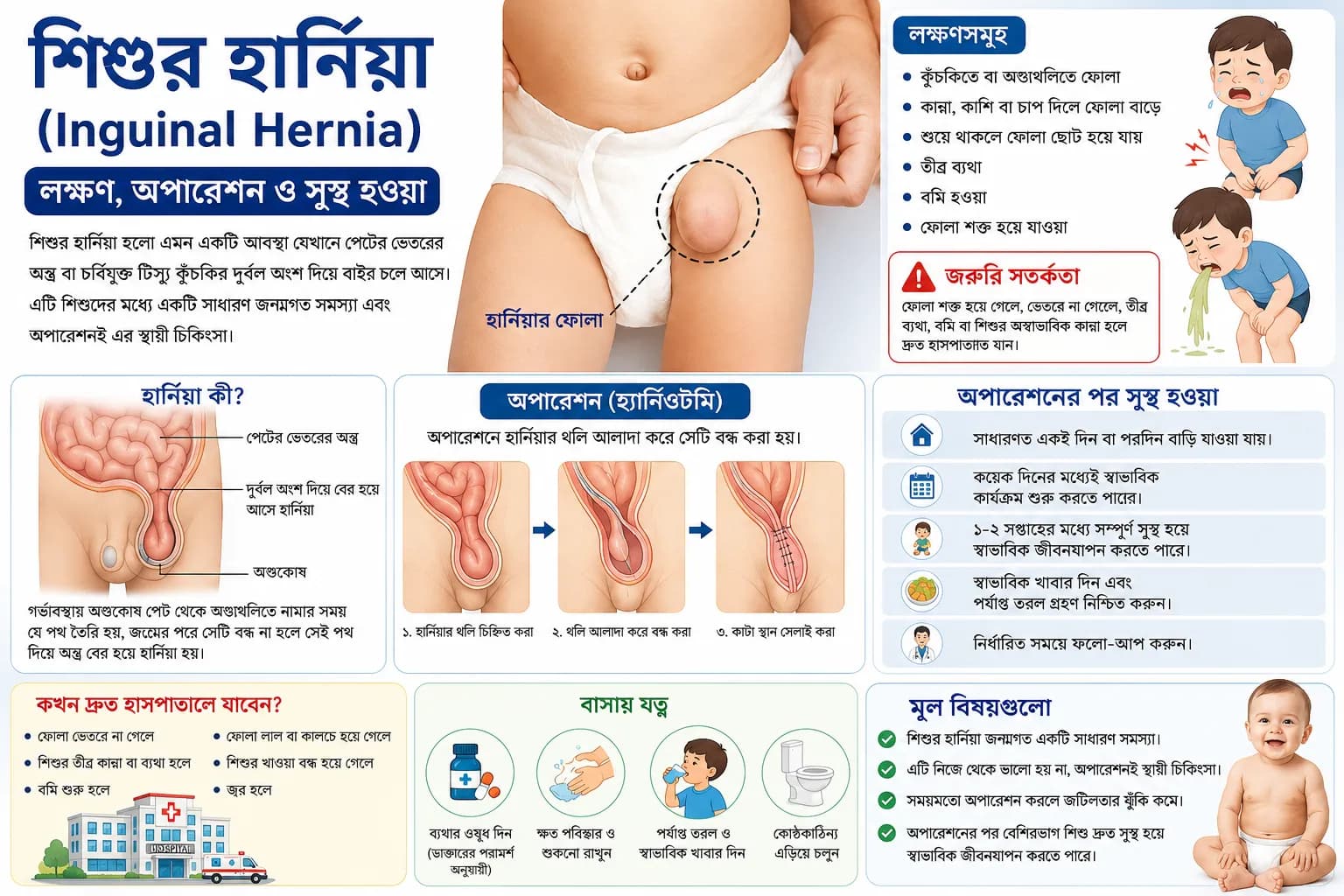 শিশুর হার্নিয়া (Inguinal Hernia): লক্ষণ, অপারেশন ও সুস্থ হওয়া
