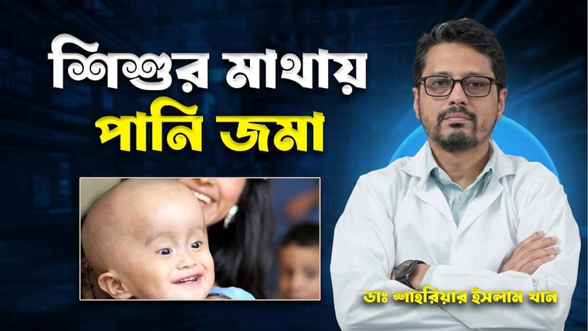 শিশুর মাথায় পানি জমা: লক্ষণ, কারণ, চিকিৎসা ও কখন অপারেশন জরুরি?