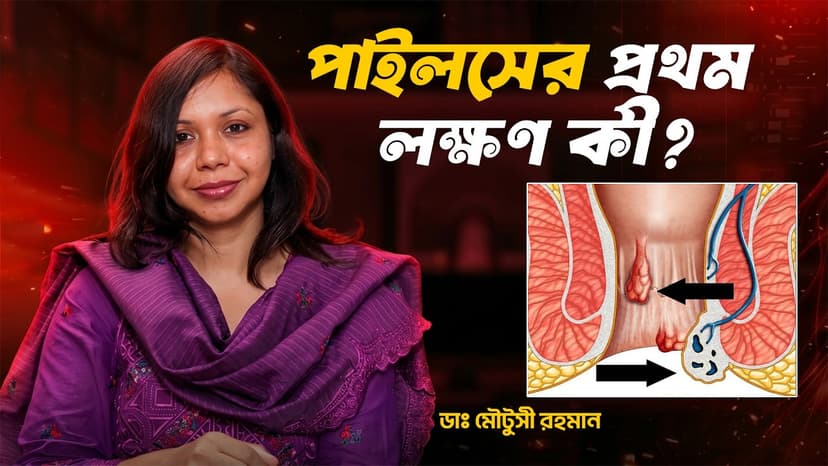 পাইলসের লক্ষণ কী? পায়খানার সঙ্গে রক্ত গেলে কি পাইলস হয়?