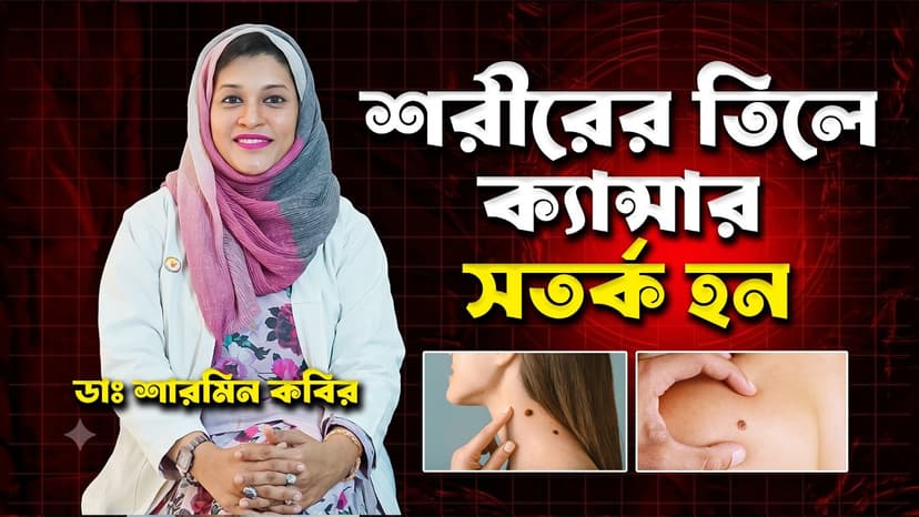 শরীরের তিল কি ক্যান্সারে পরিণত হতে পারে? তিল, স্কিন ক্যান্সারের লক্ষণ ও কখন সতর্ক হবেন