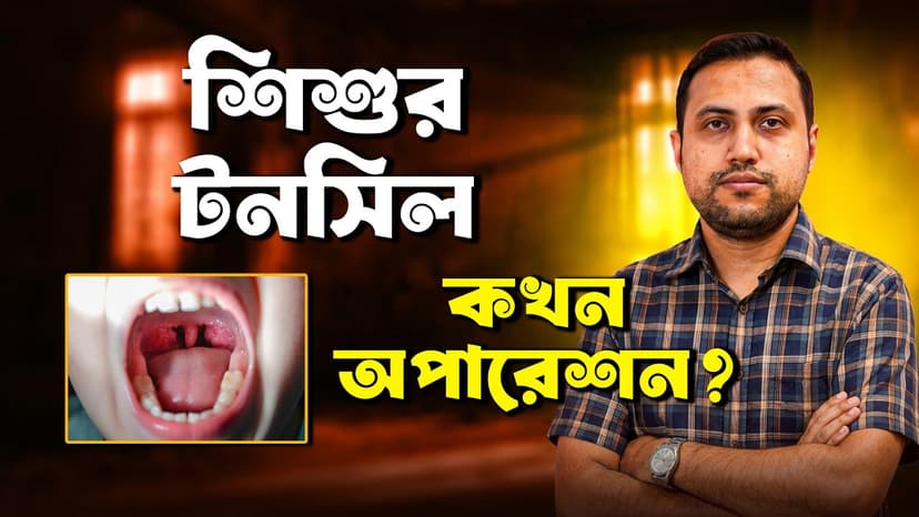 শিশুর টনসিল ও এডিনয়েড: লক্ষণ, চিকিৎসা ও কখন অপারেশন দরকার?