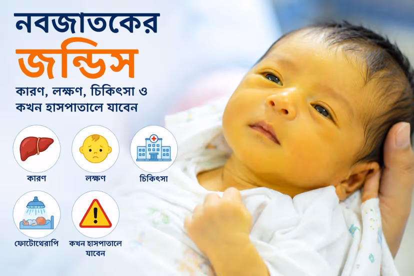 নবজাতকের জন্ডিস: কারণ, লক্ষণ, চিকিৎসা ও কখন হাসপাতালে যাবেন