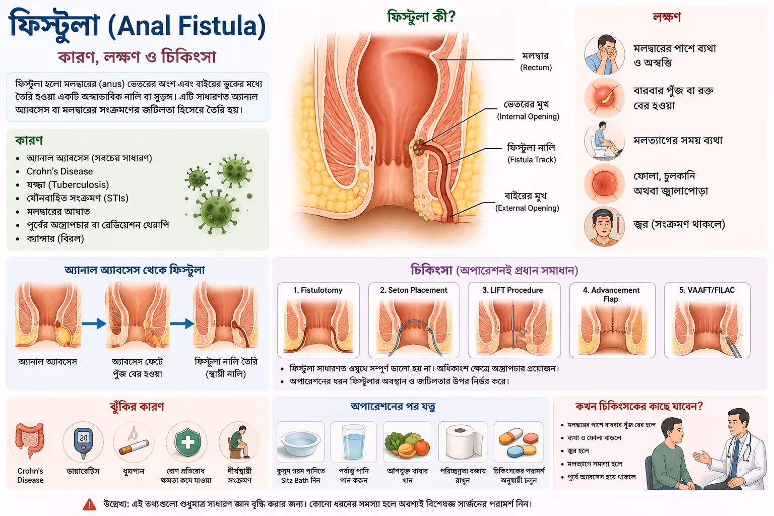 ফিস্টুলা (Anal Fistula): কারণ, লক্ষণ, চিকিৎসা ও কখন অপারেশন প্রয়োজন