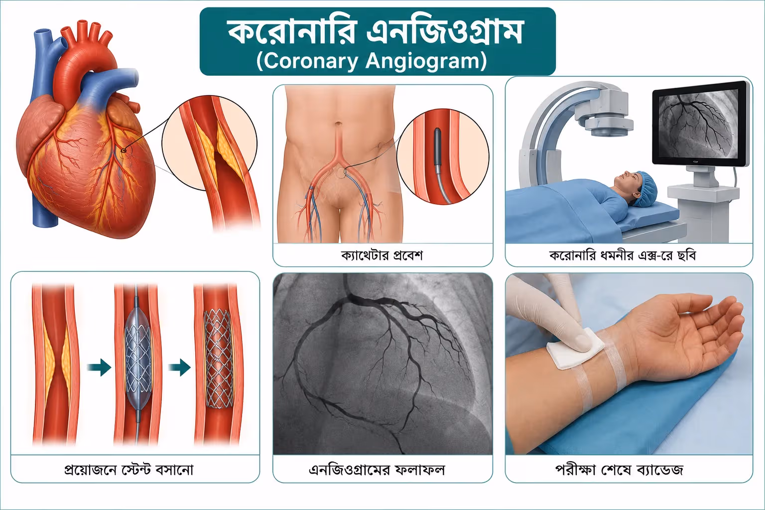 করোনারি এনজিওগ্রাম (Coronary Angiogram): কেন করা হয়, ঝুঁকি, প্রস্তুতি ও কী আশা করবেন