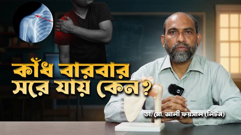 কাঁধের হাড় সরে গেলে কী করবেন? Shoulder Dislocation-এর লক্ষণ, চিকিৎসা ও অপারেশন