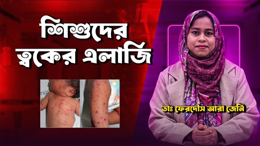 শিশুর গায়ে লাল দাগ ও ছোট ছোট দানা: কারণ, চুলকানি, চিকিৎসা ও কখন ডাক্তার দেখাবেন