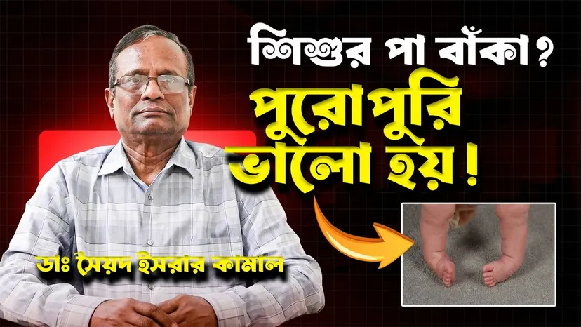 জন্মগত পা বাঁকা (Clubfoot) কেন হয়? লক্ষণ, চিকিৎসা ও সম্পূর্ণ সুস্থ হওয়ার সম্ভাবনা