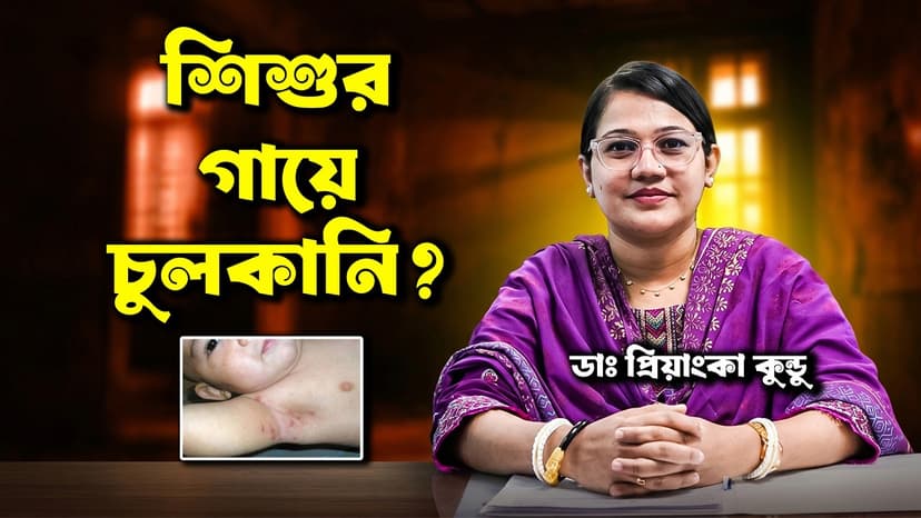 শিশুর খোসপাঁচড়া (স্ক্যাবিস) কেন হয়? লক্ষণ, চিকিৎসা ও দ্রুত মুক্তির উপায়