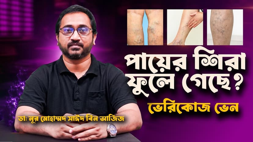 পায়ের শিরা ফুলে যায় কেন? ভেরিকোজ ভেনের লক্ষণ, চিকিৎসা ও লেজার সমাধান