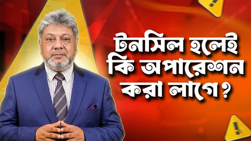 টনসিল হলেই কি অপারেশন করতে হয়? টনসিলের লক্ষণ, চিকিৎসা ও বিশেষজ্ঞের পরামর্শ
