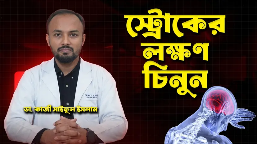 স্ট্রোকের লক্ষণ কী? FAST Rule, জরুরি চিকিৎসা ও স্ট্রোক প্রতিরোধের উপায়