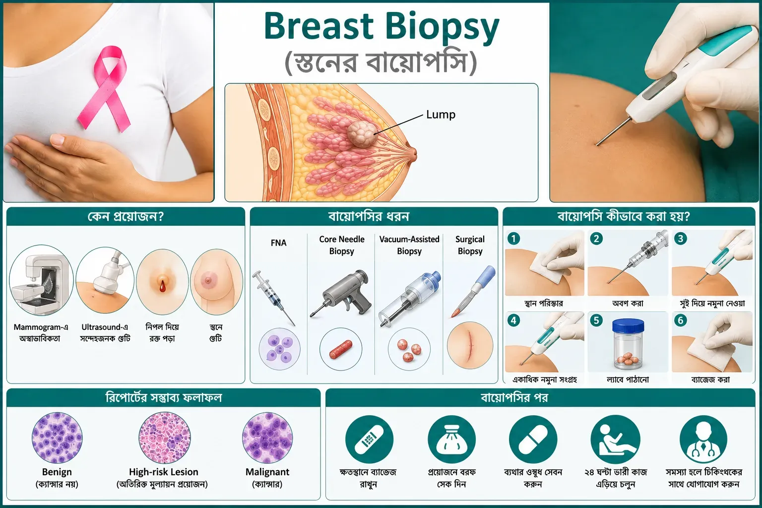 Breast Biopsy (স্তনের বায়োপসি): কীভাবে করা হয়, কেন প্রয়োজন, ঝুঁকি ও রিপোর্টের অর্থ