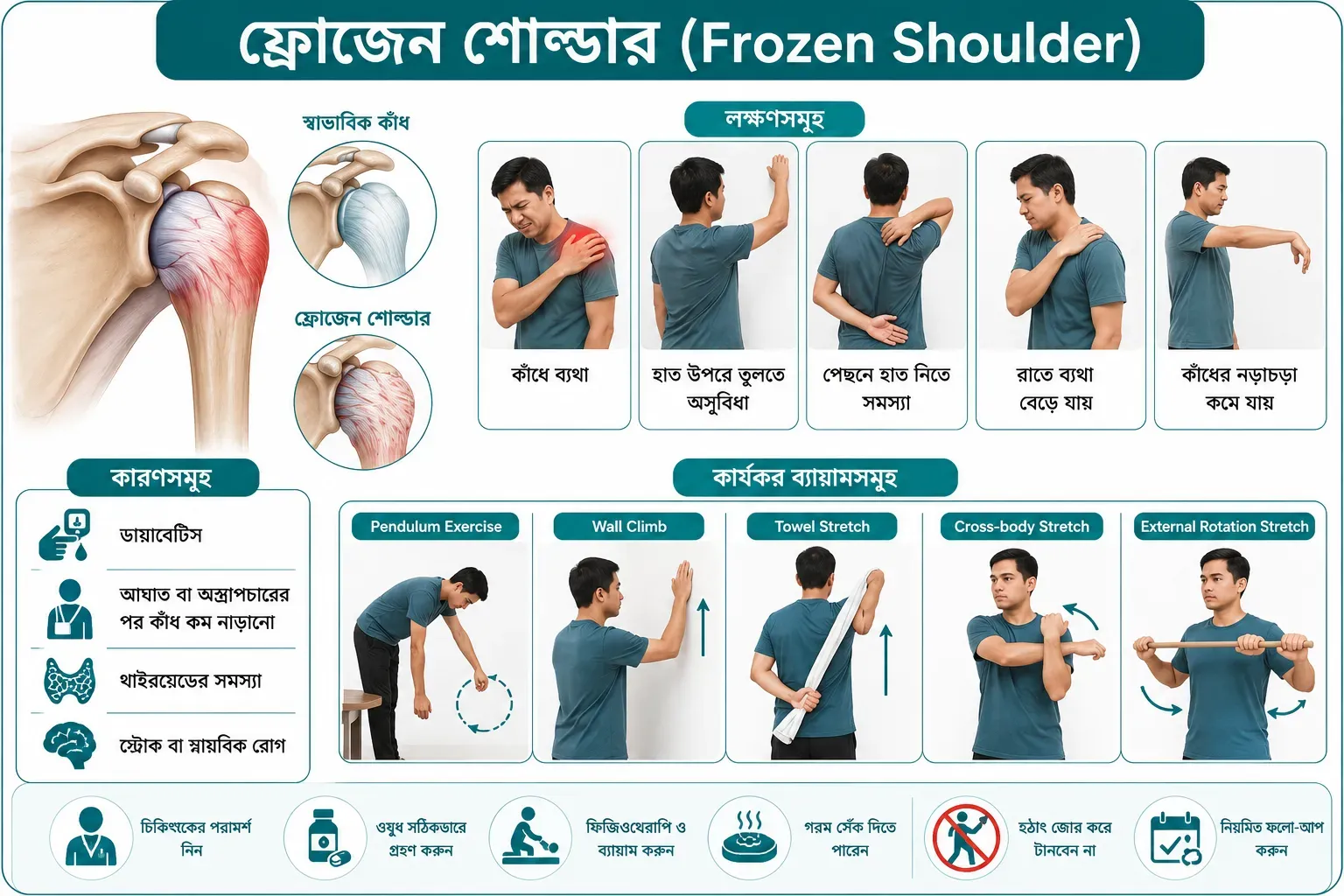ফ্রোজেন শোল্ডার (Frozen Shoulder): কারণ, লক্ষণ, চিকিৎসা, ব্যায়াম ও সুস্থ হওয়ার উপায়