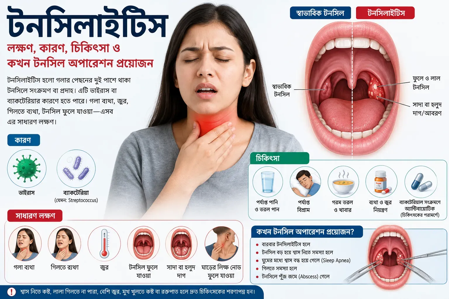 tonsillitis-symptoms-causes-treatment-tonsil-surgery-bangladesh