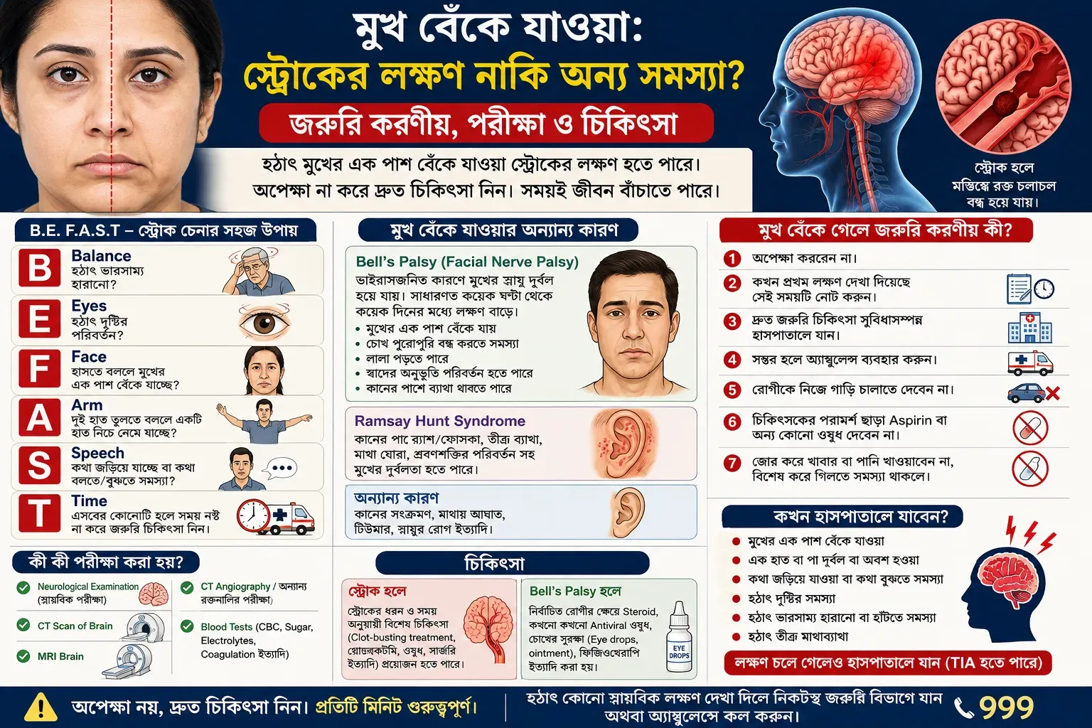 facial-drooping-recognize-stroke-act-fast